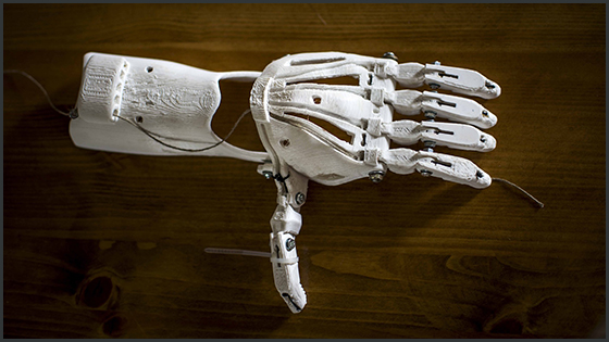 Illustration 560x315 pixabay splotramienny prostetic 1273183 3D-printed prosthetic arm