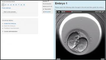 Illustration 560x315 embryo celine jones screenshot of an online quiz with a video of a developing human embryo